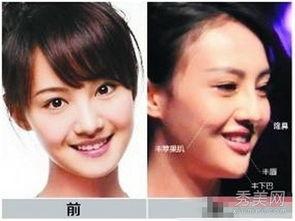 郑州整形失败爆料事件视频,揭秘美容行业潜规则与风险  第3张 郑州整形失败爆料事件视频,揭秘美容行业潜规则与风险  第3张